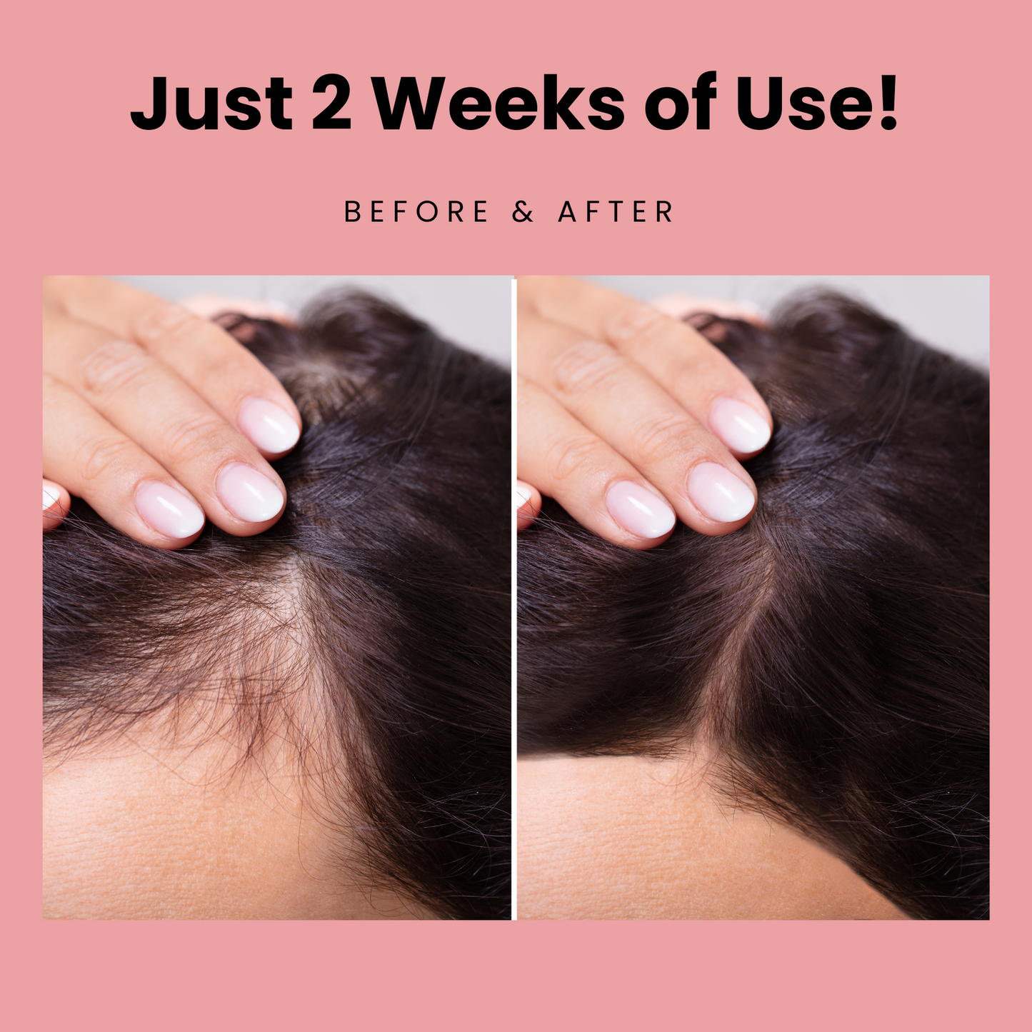Rosemary Hair Growth Roller