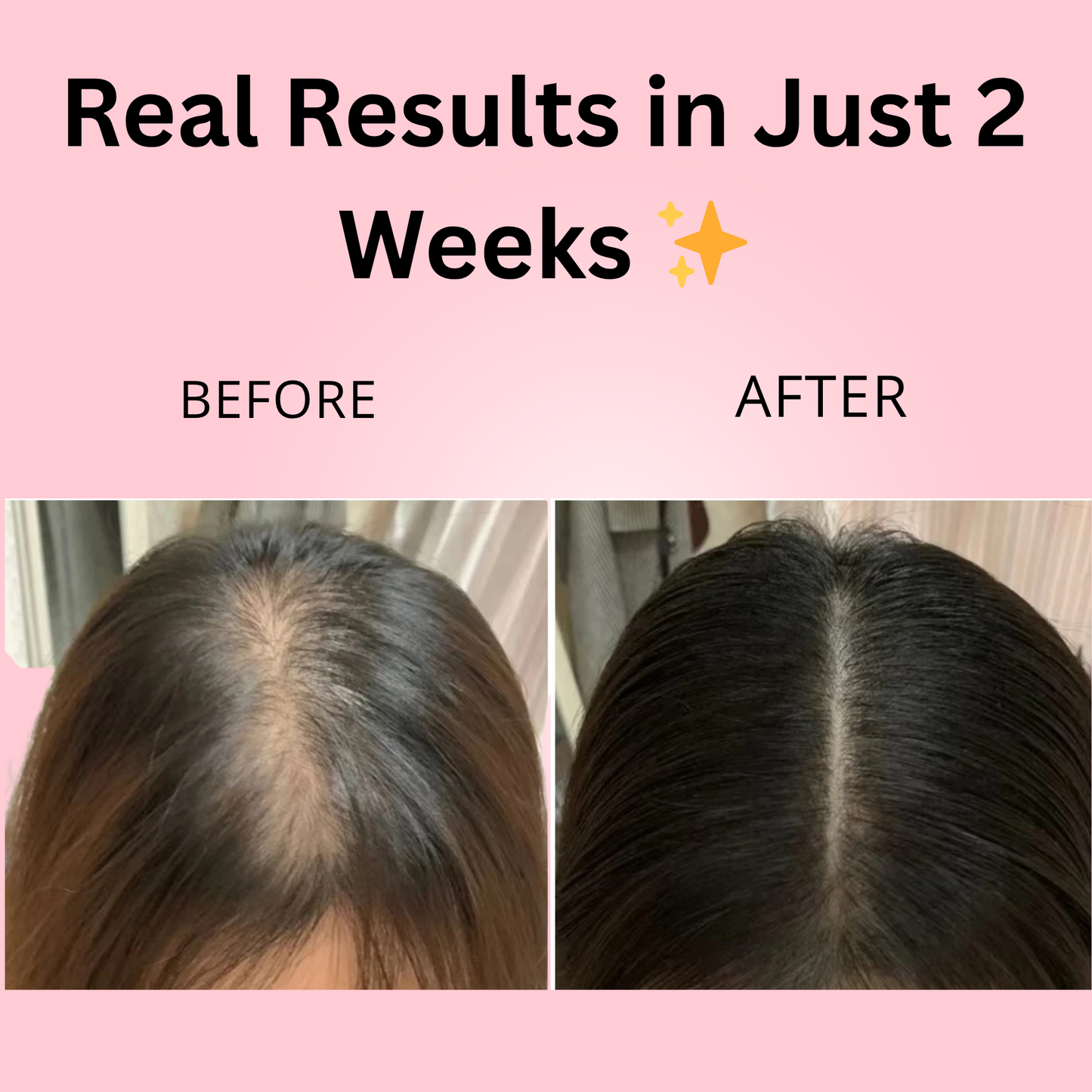 Rosemary Hair Growth Roller