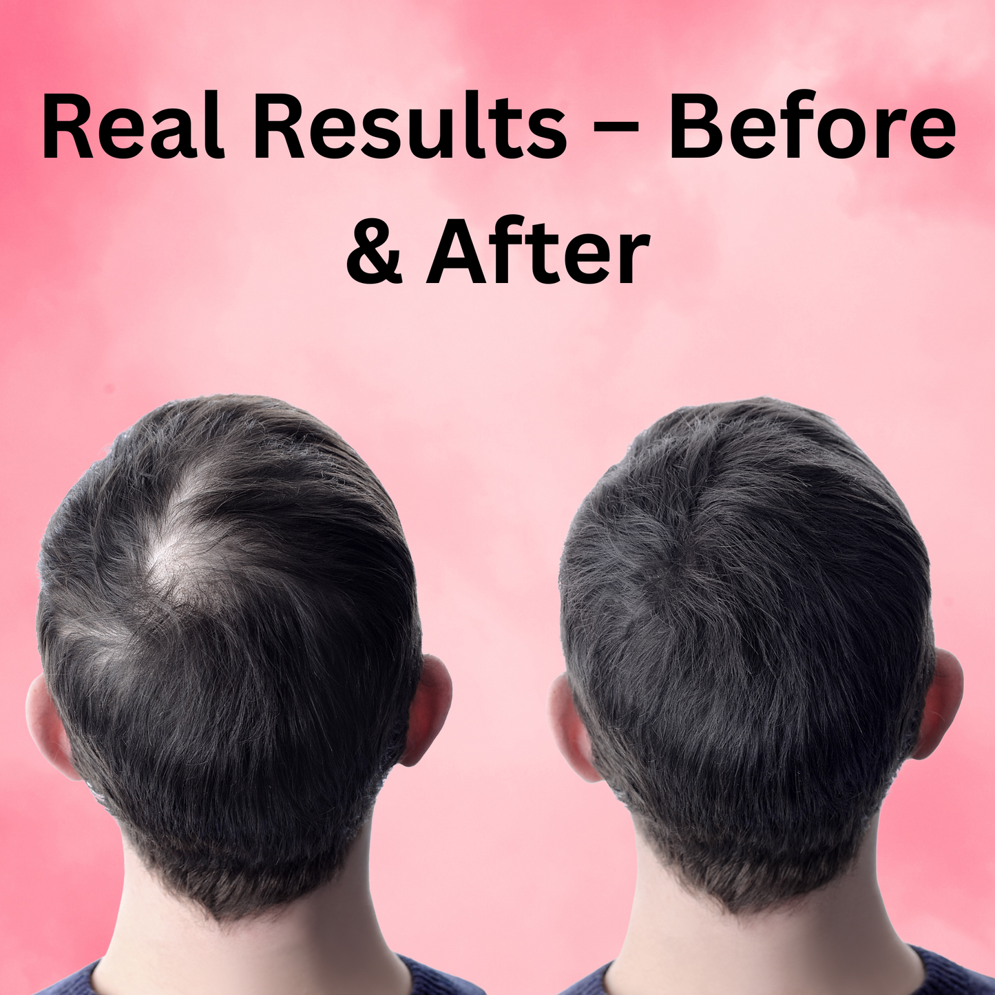 Rosemary Hair Growth Roller