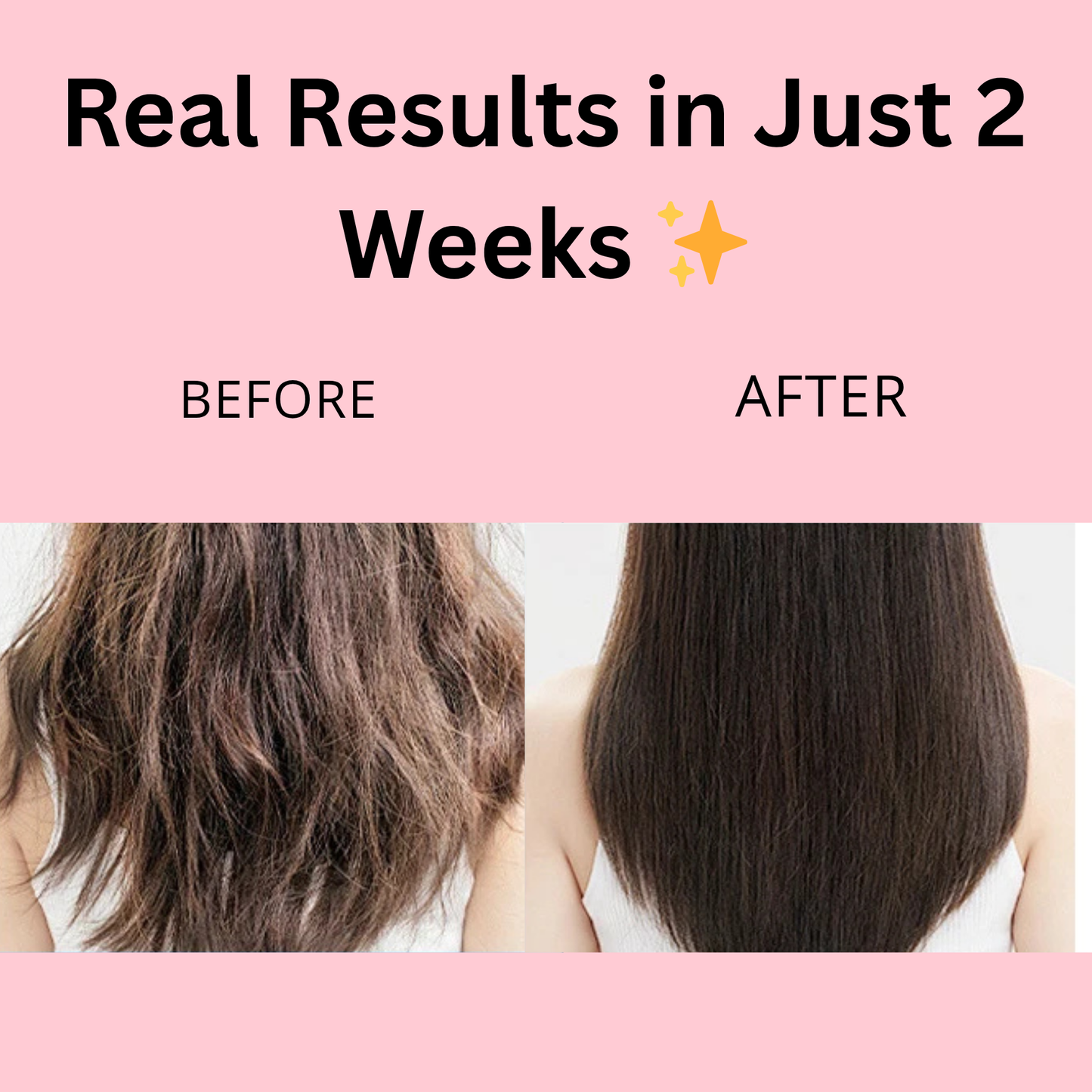 Rosemary Hair Growth Roller