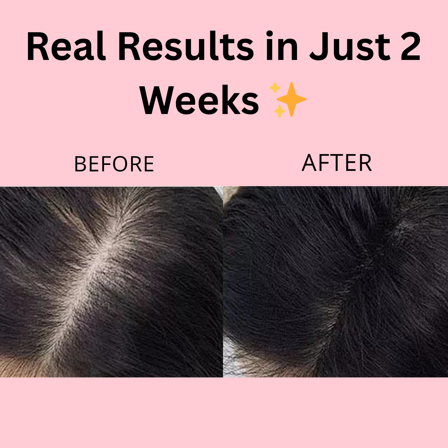 Rosemary Hair Growth Roller