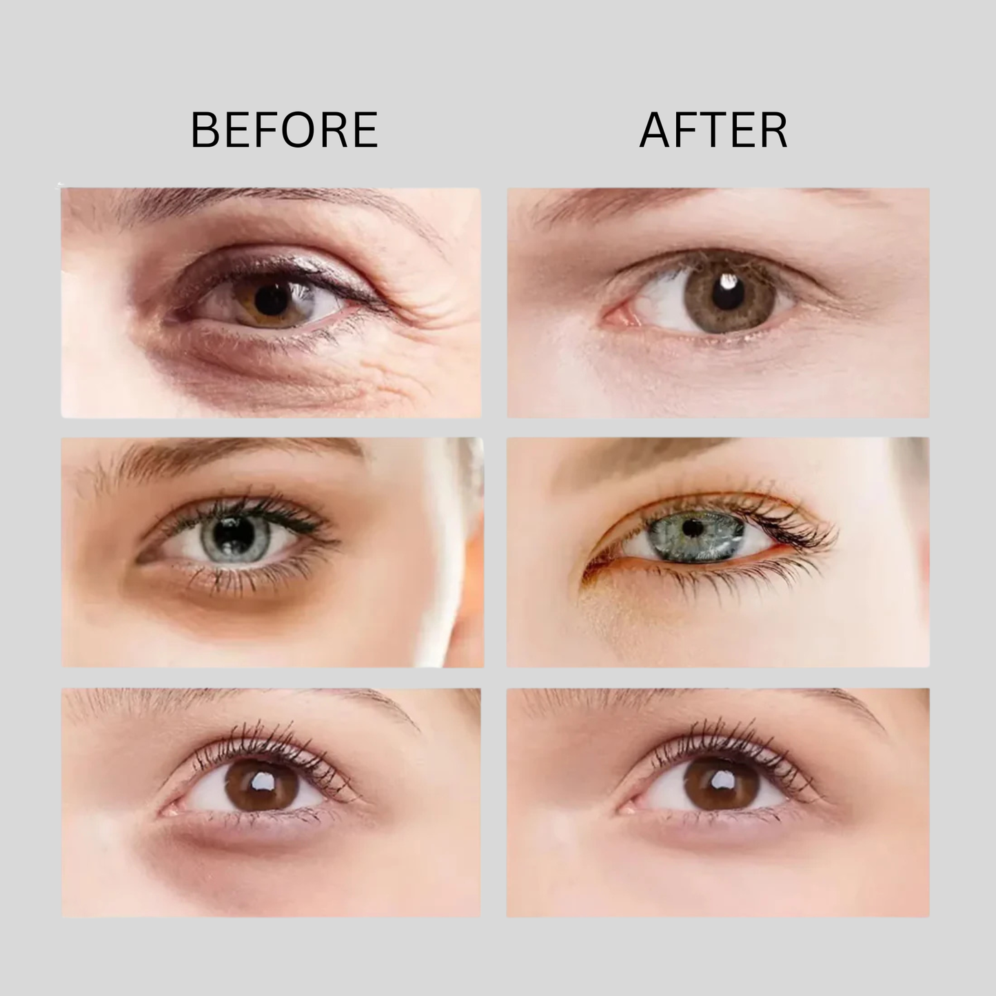 Radiant Eyes Miracle Cream