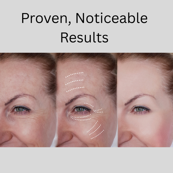 Radiant Eyes Miracle Cream