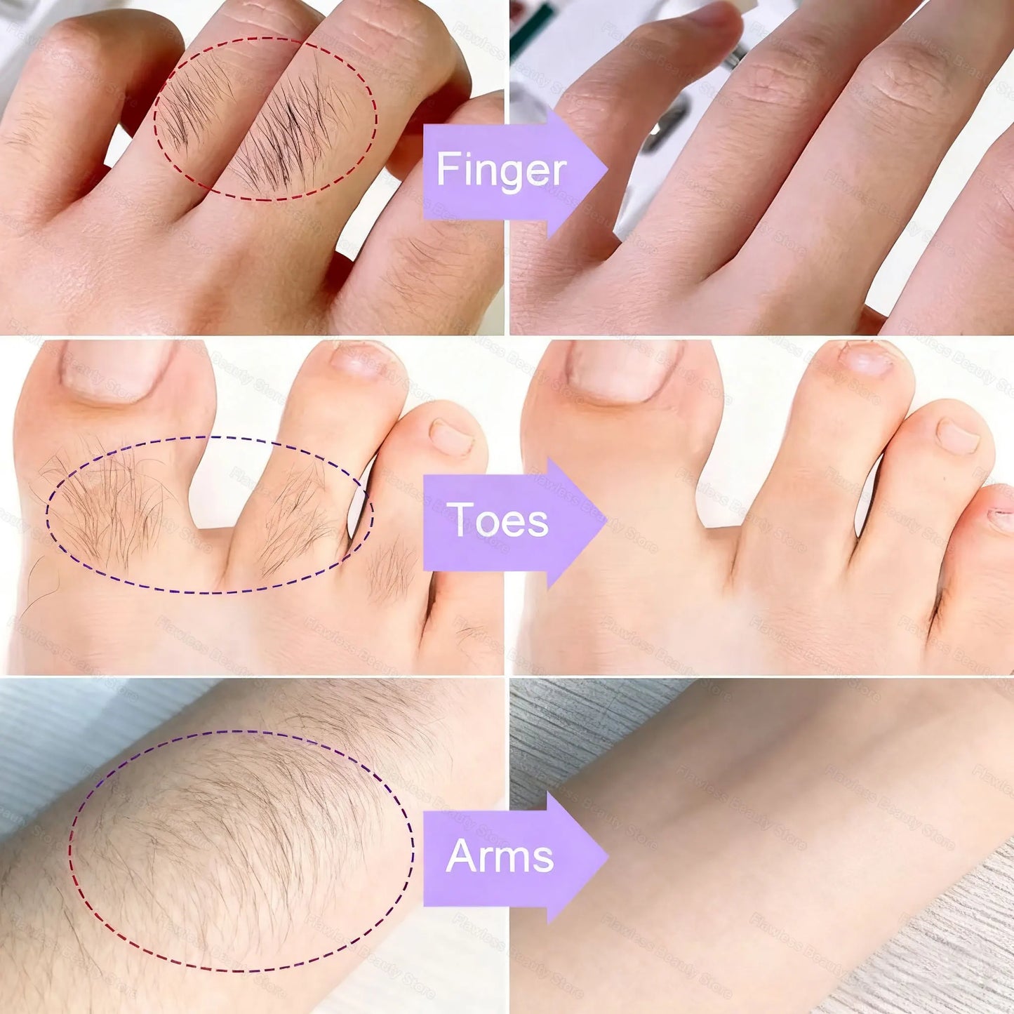 Smooth Skin Hair Removal Cream