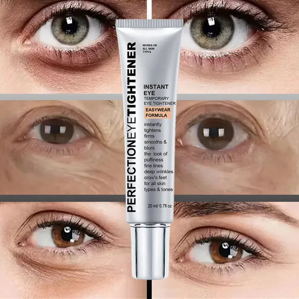 Radiant Eyes Miracle Cream